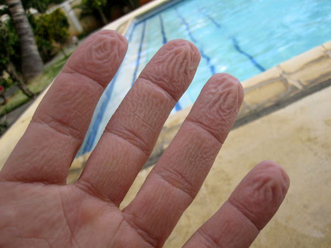 http://www.wired.com/images_blogs/wiredscience/2011/03/Wrinkled-fingers.jpg